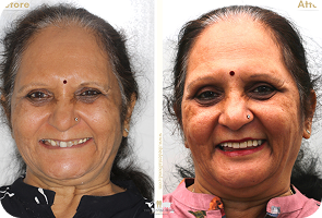 Neha Joshi Before